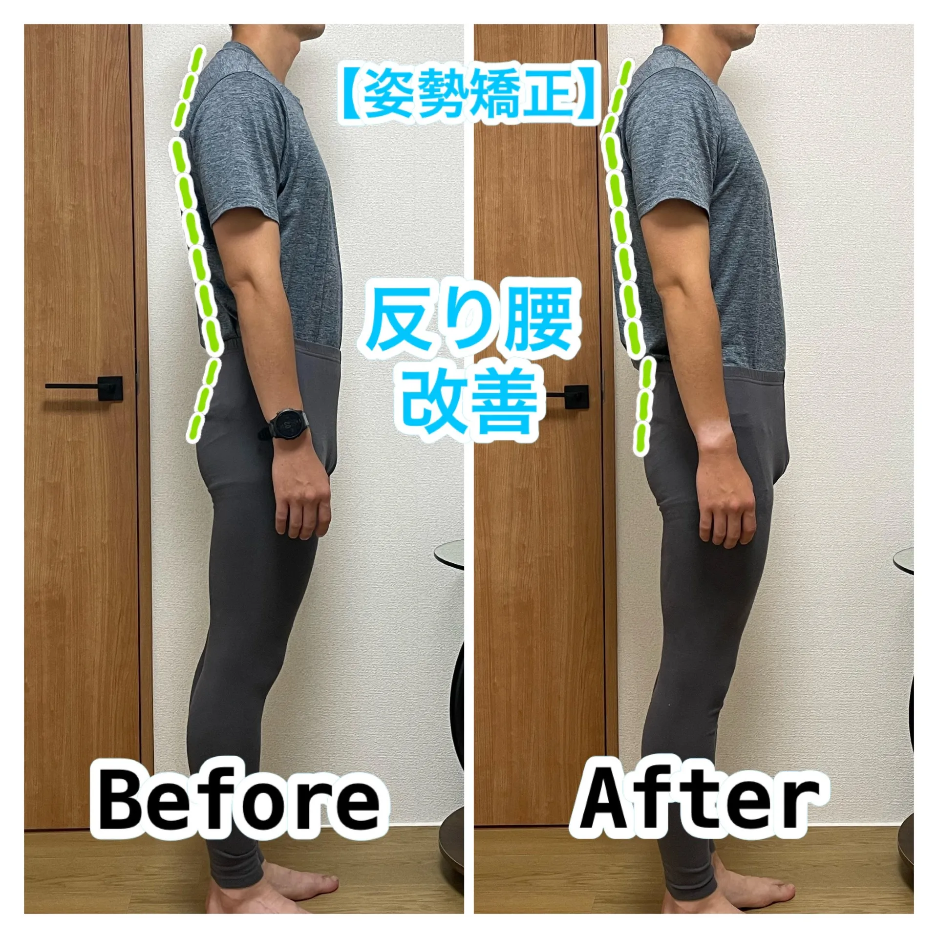 Before & After 30代 デスクワークのお客様 : 腰痛、首こり、肩、首、背中のハリ改善例